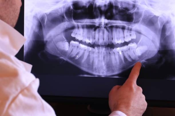 Best Emergency Dental Services for Seniors in Irvine, CA